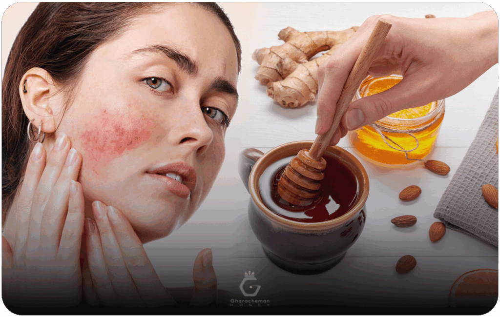 شواهد علمی درباره عسل و اگزما