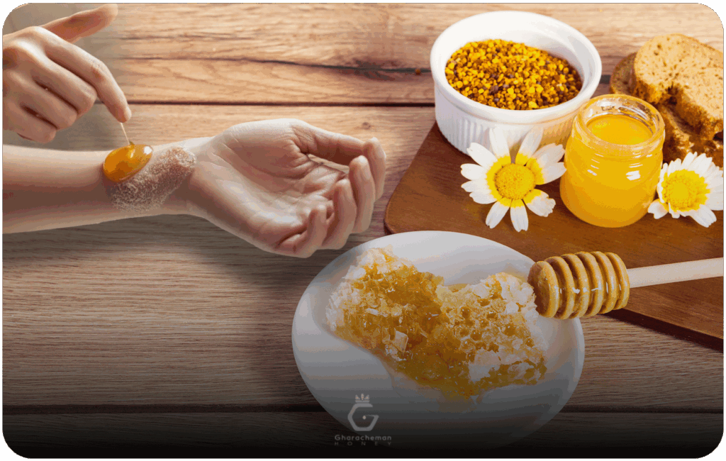 روش‌های استفاده از عسل برای اگزما